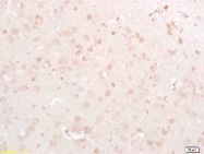 bs-4100R - Dynamin-1-like protein