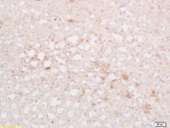 bs-4100R - Dynamin-1-like protein