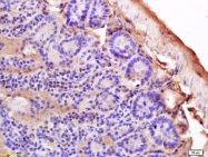 bs-4107R - HLA class II DP beta 1 / HLA-DPB1