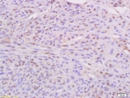 bs-4114R - IKBKE / IKKE