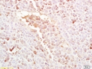 bs-4117R - LRP5
