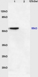 bs-4139R - NFKBIE / IKBE