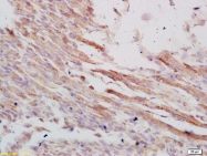 bs-4228R - VLDL-R / VLDL receptor