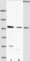 bs-4228R - VLDL-R / VLDL receptor
