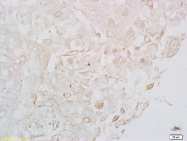 bs-4245R - LONP1 / PRSS15