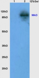 bs-4245R - LONP1 / PRSS15