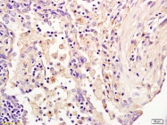 bs-4281R - USP7 / HAUSP