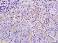 bs-4293R - MACC1