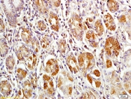 bs-4293R - MACC1