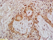 bs-4293R - MACC1