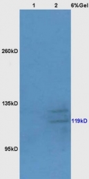 bs-4294R - BUB1A