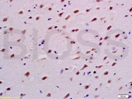 bs-4512R - TUBB3 / TUBB4