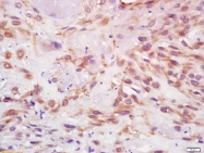 bs-4588R - Insulin-like growth factor I / IGF1