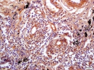bs-4614R - CD54 / ICAM1