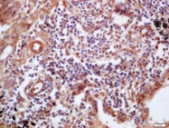 bs-4616R - CD54 / ICAM1