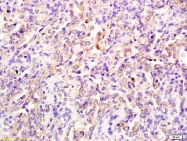 bs-4749R - Integrin beta-6 / ITGB6