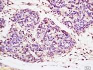 bs-4960R - Beta-galactosidase