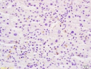 bs-4960R - Beta-galactosidase