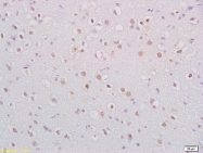 bs-4989R - BDNF