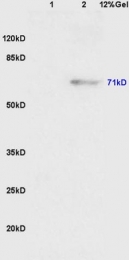 bs-5218R - WEE1 / Wee1-like protein kinase