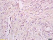 bs-5457R - IFNAR1