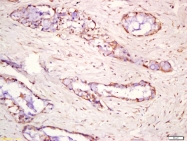 bs-5486R - MAPK7 / ERK5