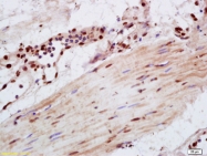 bs-5593R - VAV1