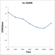 bs-5600R - TSC1 / Hamartin