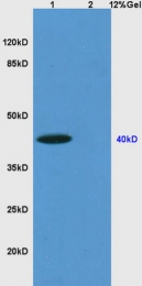 bs-5798R - BNIP3L / BNIP3A
