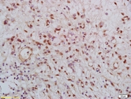 bs-5871R - KLK8 / Kallikrein-8