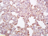 bs-5884R - Endomucin