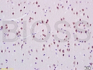 bs-5927R - ANP32C