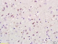 bs-6016R - RBBP5 / RBQ3