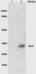 bs-6115R - TUSC3 / N33