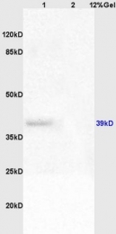bs-6134R - WNT4