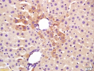 bs-6196R - Transglutaminase-2 (TGM2)