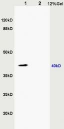 bs-6200R - ZDHHC9