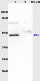 bs-6260R - UHMK1 / KIST