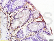 bs-6319R - Interleukin-1 beta / IL-1B