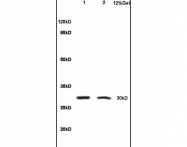 bs-6319R - Interleukin-1 beta / IL-1B