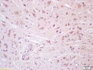 bs-6425R - TRPV4 / Vanilloid receptor-like protein 2