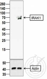 bs-6464R - IRAK1