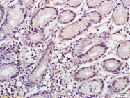 bs-6552R - NANOGP8