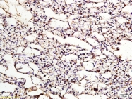 bs-6651R - APOER2 / LRP8
