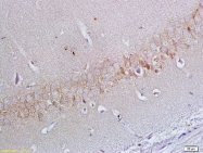 bs-6651R - APOER2 / LRP8