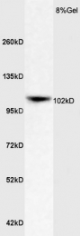 bs-6651R - APOER2 / LRP8