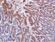 bs-6664R - Histamine H2 receptor