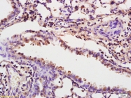 bs-6895R - Fibrinogen gamma chain