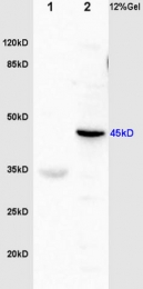 bs-6895R - Fibrinogen gamma chain