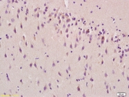 bs-6939R - Beta-Synuclein / SCNB